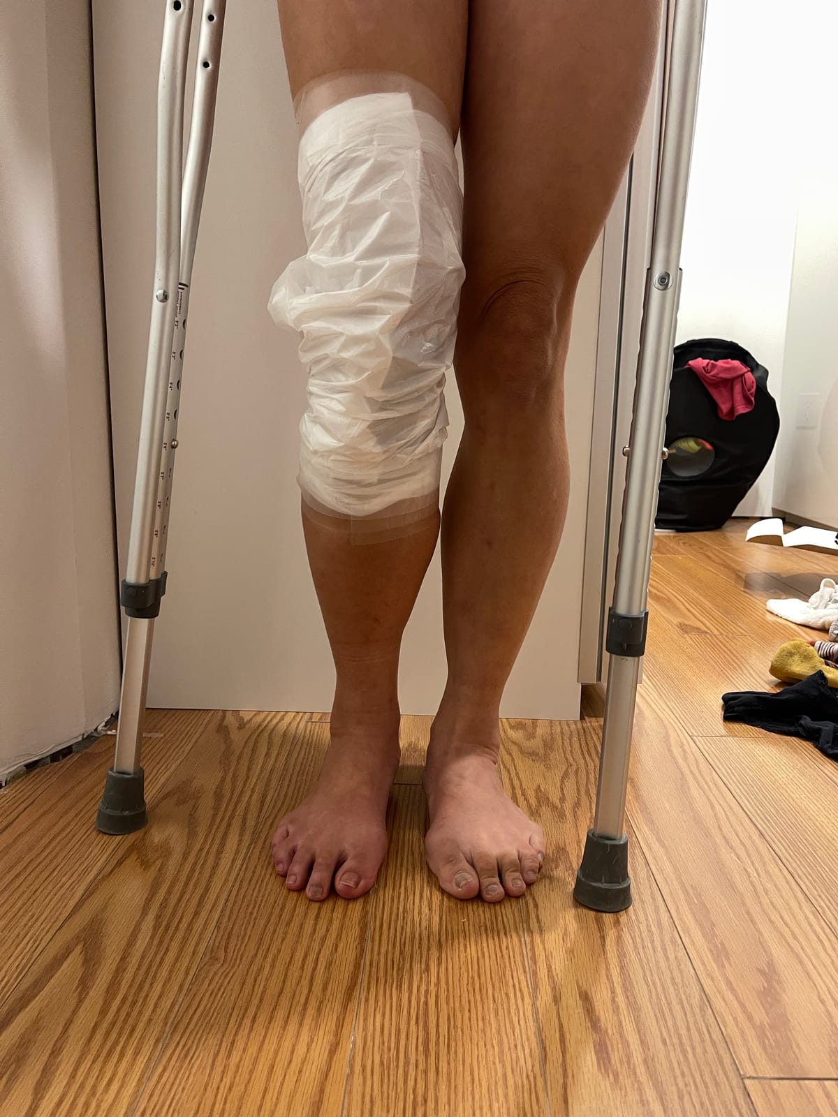 ACL Repair Day 4