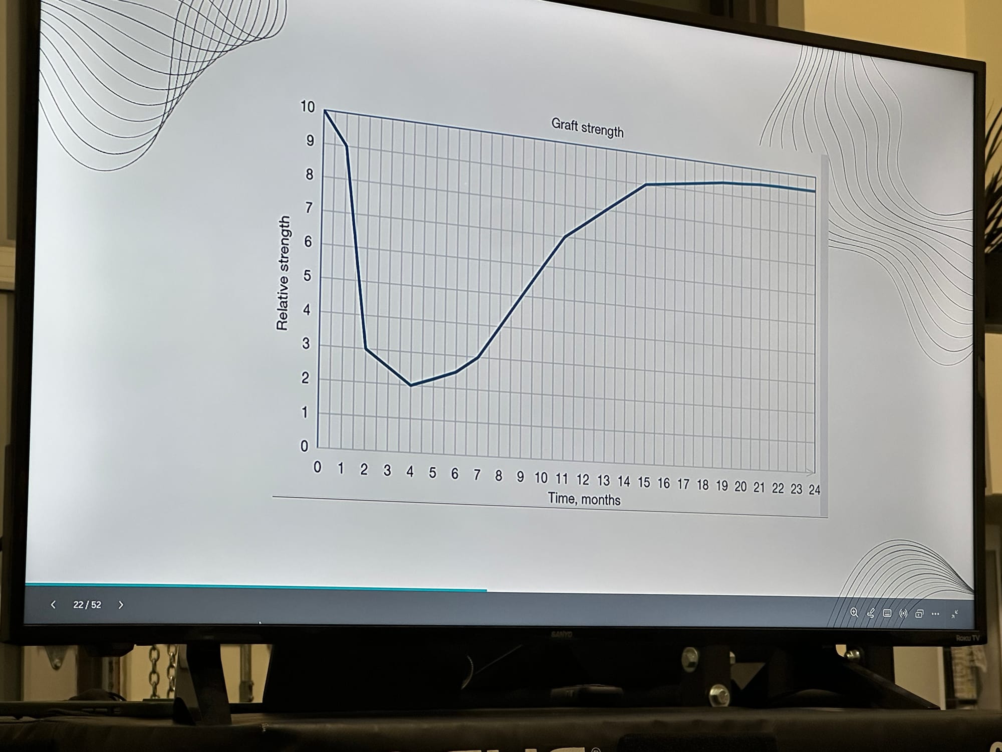 ACL Surgical Recovery Metrics