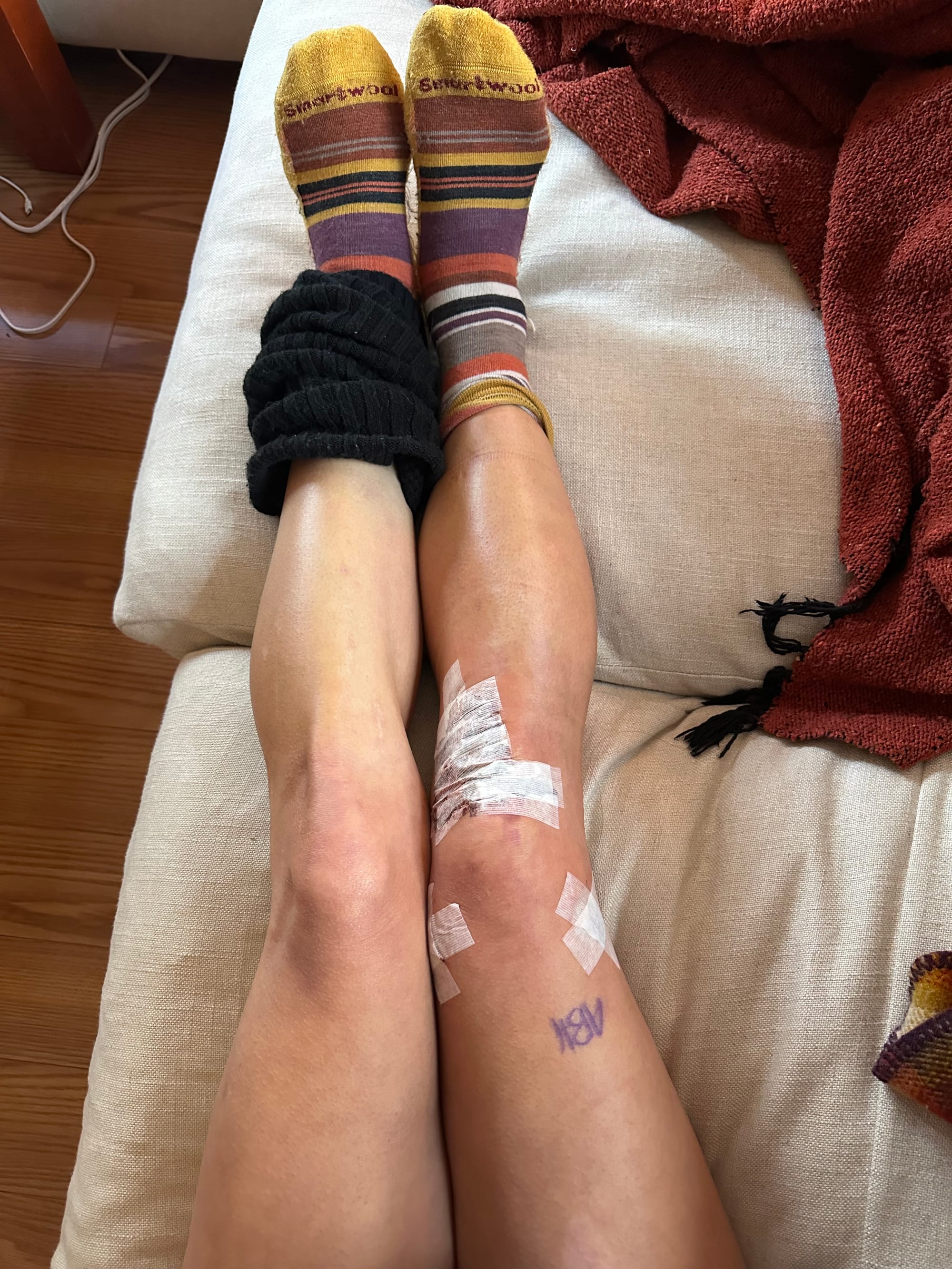 ACL Repair Day 2 + 3