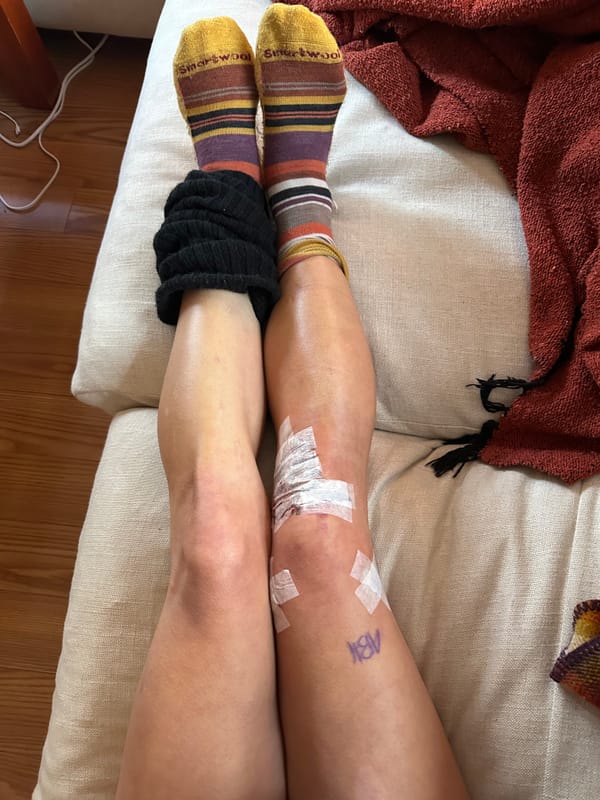 ACL Repair Day 2 + 3